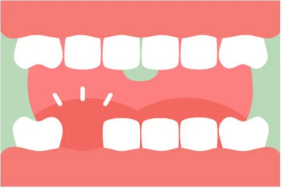 梦见牙齿掉了一个是什么意思 周公解梦梦见牙齿掉了一个