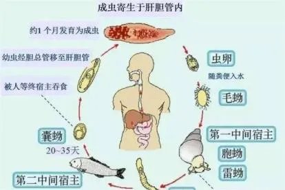 肝吸虫阳性是什么意思