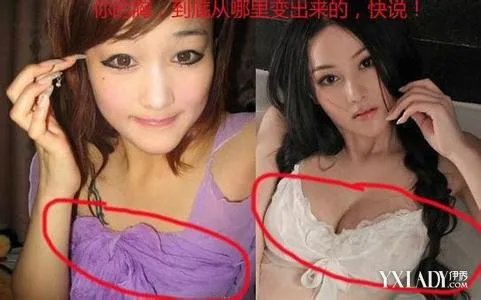 张馨予整容前后照片曝光网友吐槽”整容前也太丑了“