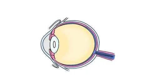 眼球充血怎么办