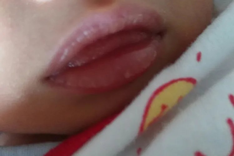 宝宝嘴唇发白2个月图片