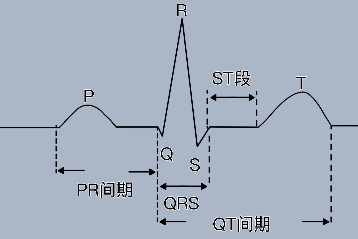 心电图PR正常值是多少