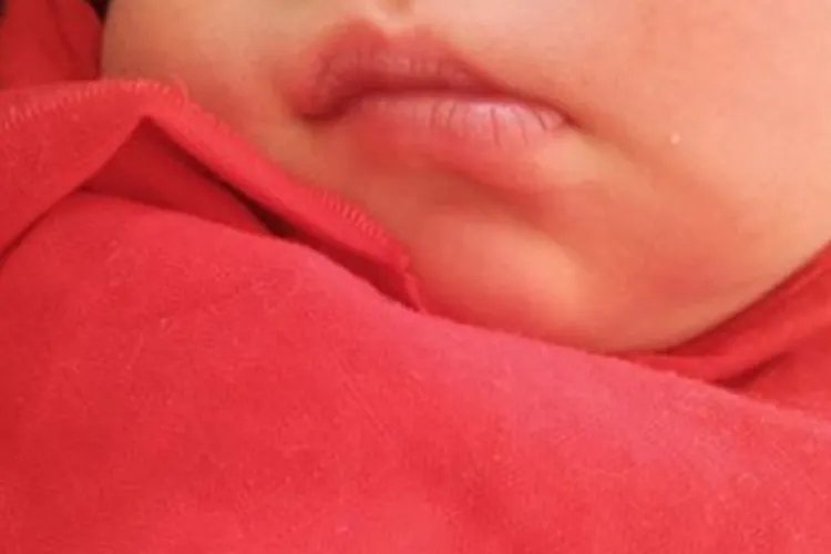 宝宝嘴唇发白2个月图片