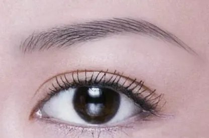 韩式压双眼皮保持多久