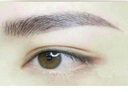 韩式无痕开眼角要花多少钱