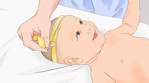 婴儿肛门湿疹如何治疗