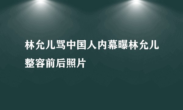 林允儿骂中国人内幕曝林允儿整容前后照片