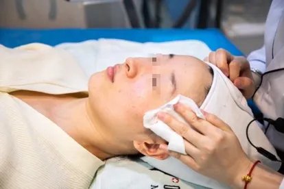 光子嫩肤过程图片