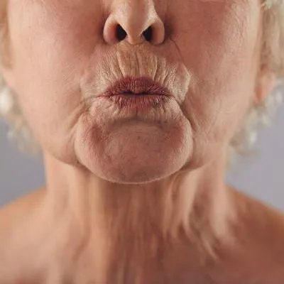 青春痘医院的治疗方法