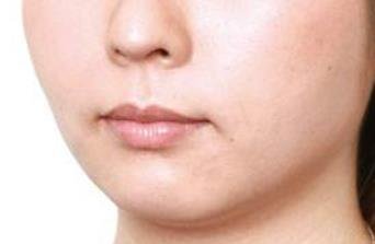 怎么用蜂蜜祛斑