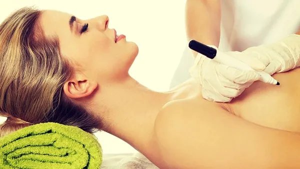 像素激光除皱术后如何护理