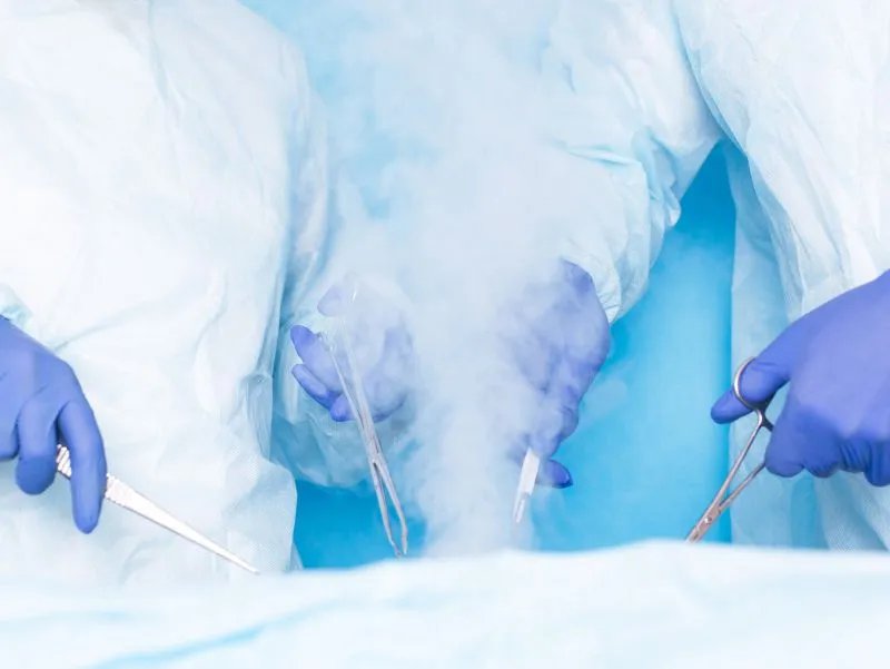 做包皮手术后注意事项