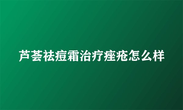 芦荟祛痘霜治疗痤疮怎么样
