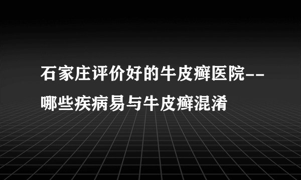 石家庄评价好的牛皮癣医院--哪些疾病易与牛皮癣混淆