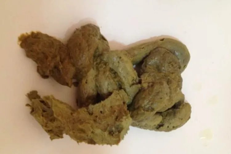 大便颜色9种图解