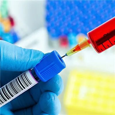 什么是淋巴管炎？