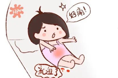 感染hpv同房后出血图片