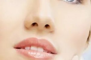 光子嫩肤注意事项