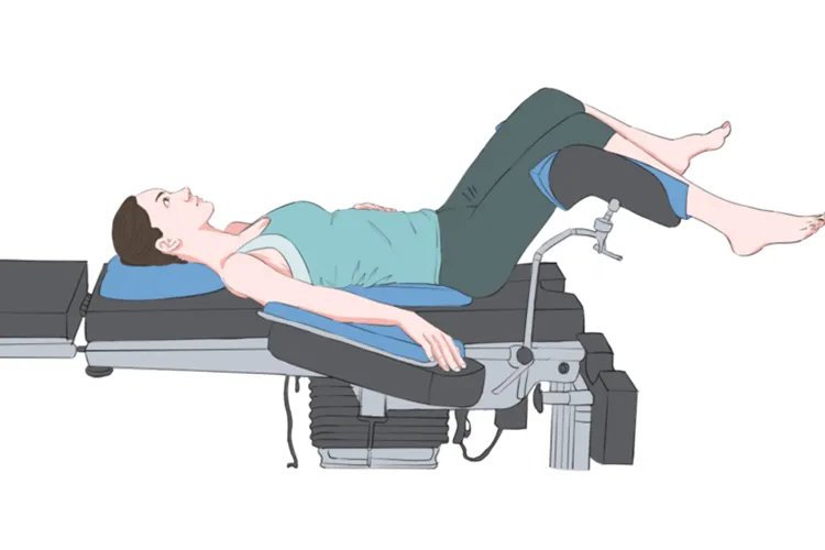 膀胱截石位图片