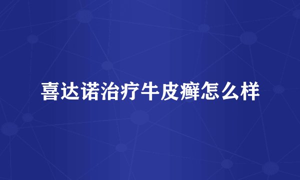 喜达诺治疗牛皮癣怎么样