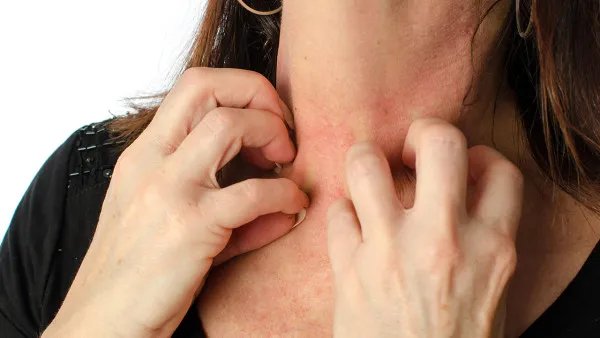 脸上长斑是什么原因？揭秘脸上长斑的5个常见原因