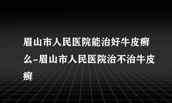 眉山市人民医院能治好牛皮癣么-眉山市人民医院治不治牛皮癣