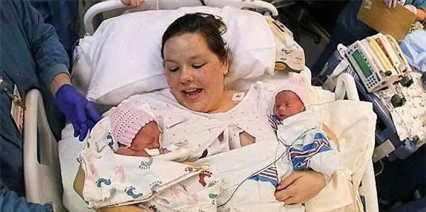 双胞胎姐妹一出生就“手牵手”，为什么分都分不开？