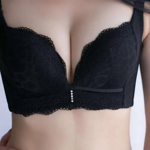 副乳手术大概多少钱