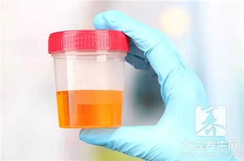 结晶尿有什么危害