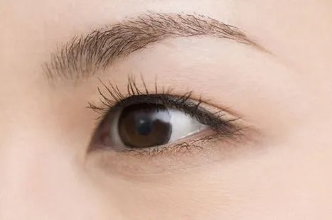 割双眼皮一般多少钱