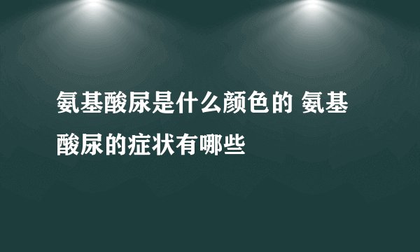 氨基酸尿是什么颜色的 氨基酸尿的症状有哪些