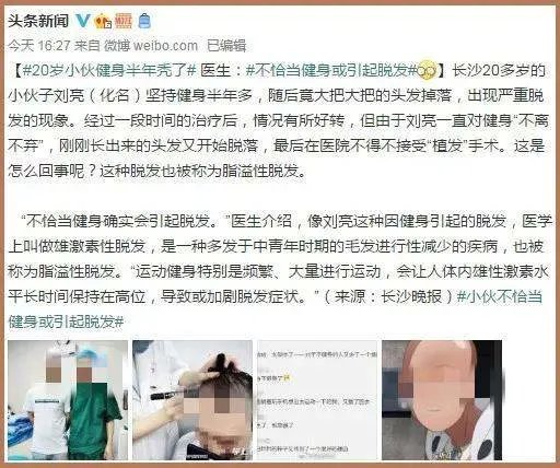 20岁小伙健身半年变秃，竟然和“坚持健身”有关系