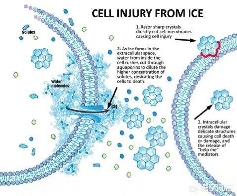 首例冷冻人复活