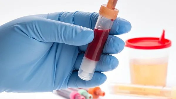 激素六项检查多少钱