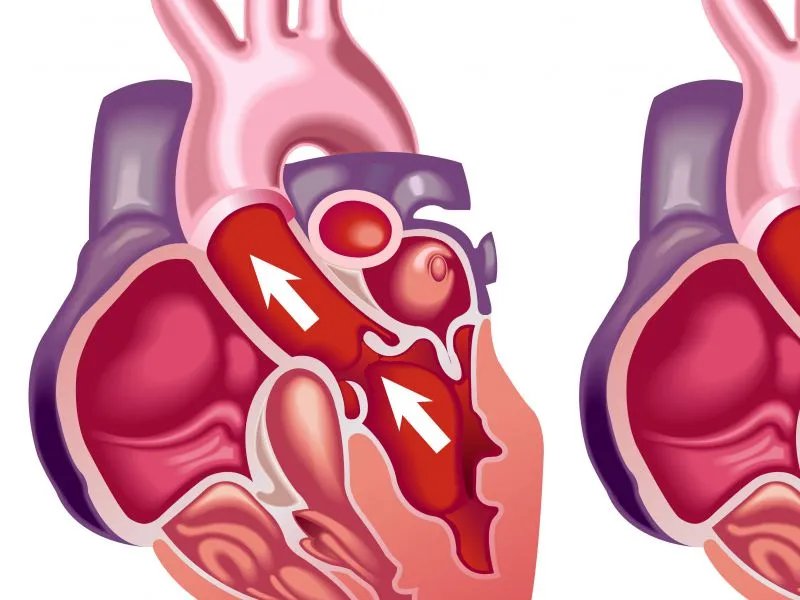 早搏的治疗方法