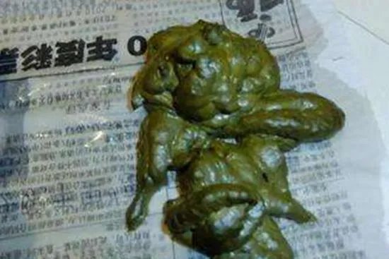 大便颜色9种图解