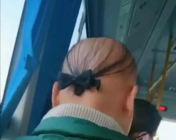 20岁小伙健身半年变秃，竟然和“坚持健身”有关系