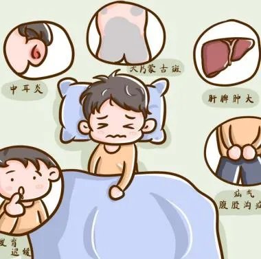 孩子背部蒙古斑是怎么形成的，是黏多糖贮积症2型吗