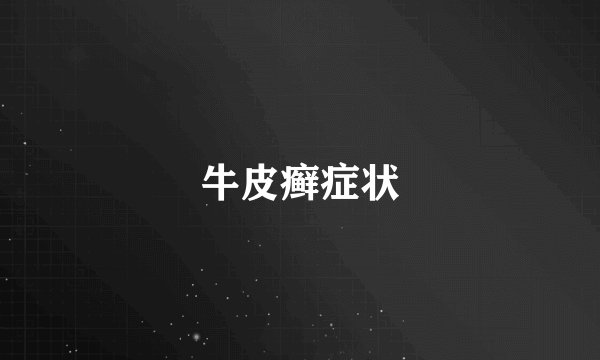 牛皮癣症状