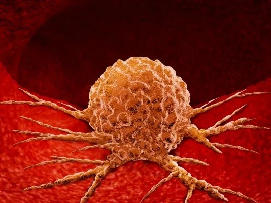 肿瘤的症状表现有哪些