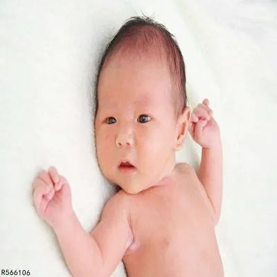 溶血性黄疸怎么办