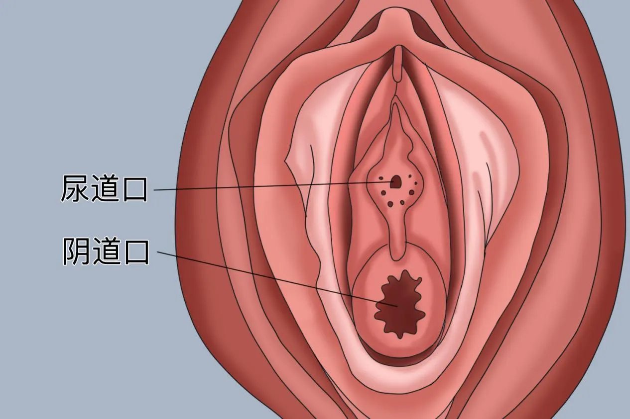 尿道口是什么样