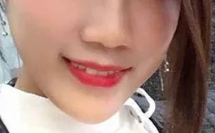 杭州格莱美医疗美容医院丰脸颊怎么样?附参考价格一览