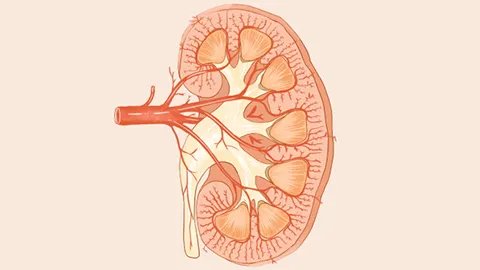 肾结石治疗最佳方案