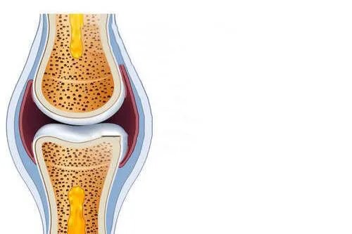 人体关节结构图