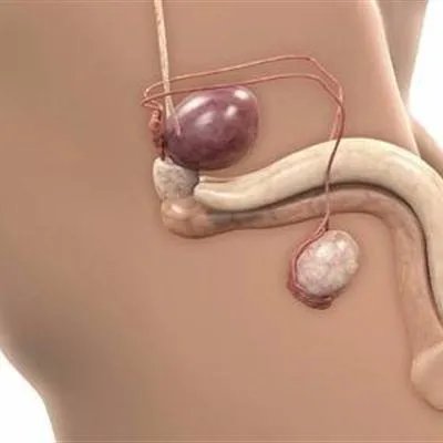 尿黄是怎么回事