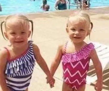 双胞胎姐妹一出生就“手牵手”，为什么分都分不开？