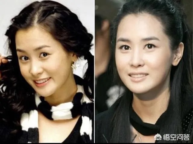 有哪些整容失败的明星？