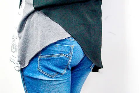 肛门瘙痒怎么弄