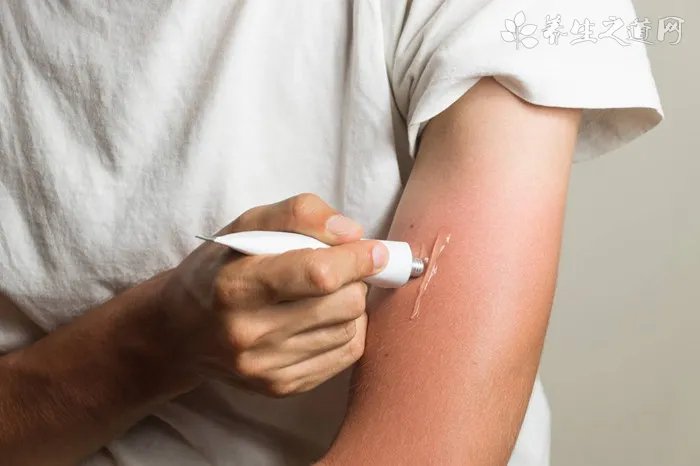 氟康唑软膏说明书